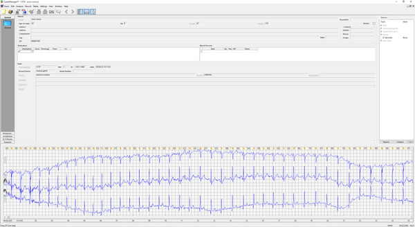 Reverse Engineering Clean Architecture
